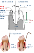 Profilassi e paradontologia - Centro Odontoiatrico Atena (BR)